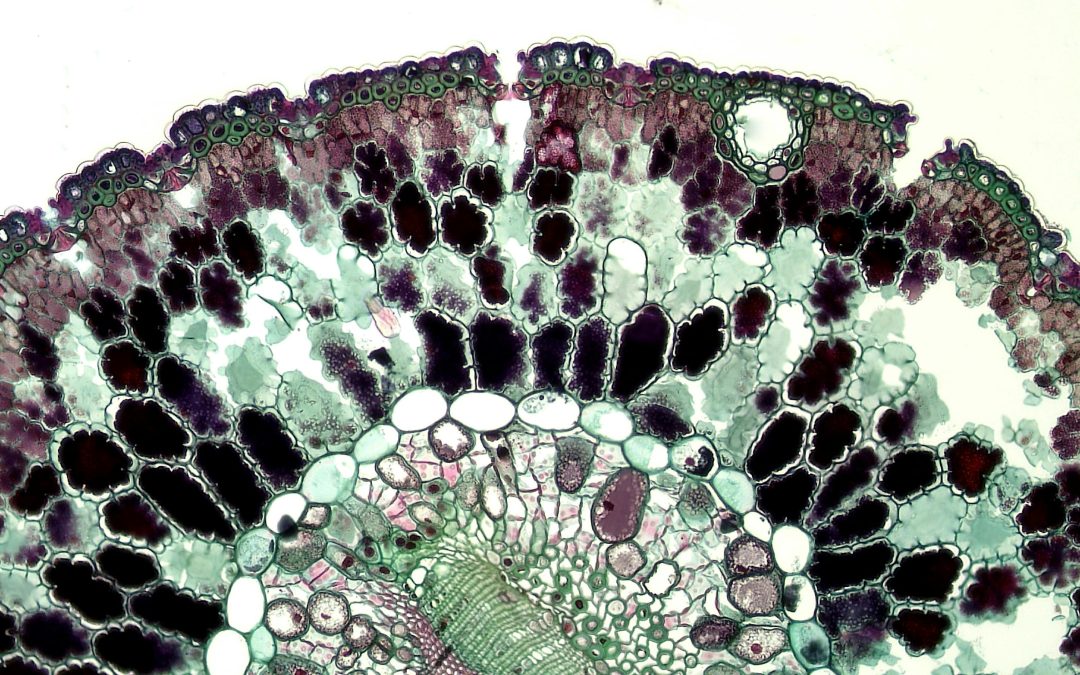 Stem Cell Therapy for Spinal Stenosis: A New Path to Relief