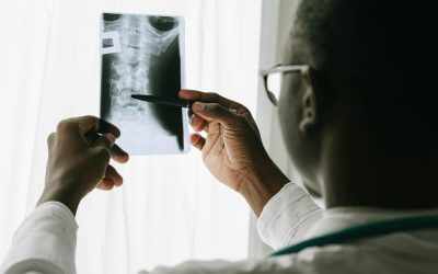 What Happens If Spinal Stenosis Is Left Untreated?