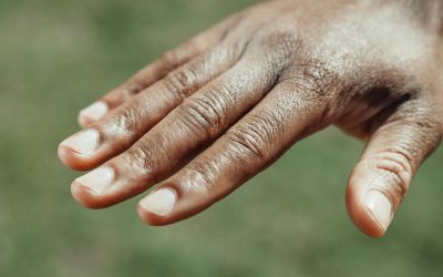 Middle Finger Knuckle Pain: Causes & Treatment