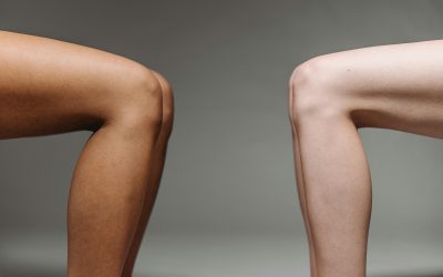 New Treatment for Torn Meniscus