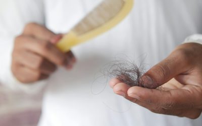 PRP Hair Treatment: What You Need To Know