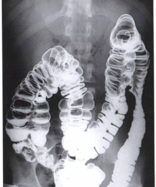 Real time X-ray