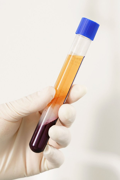 Meniscus Tears Treatments