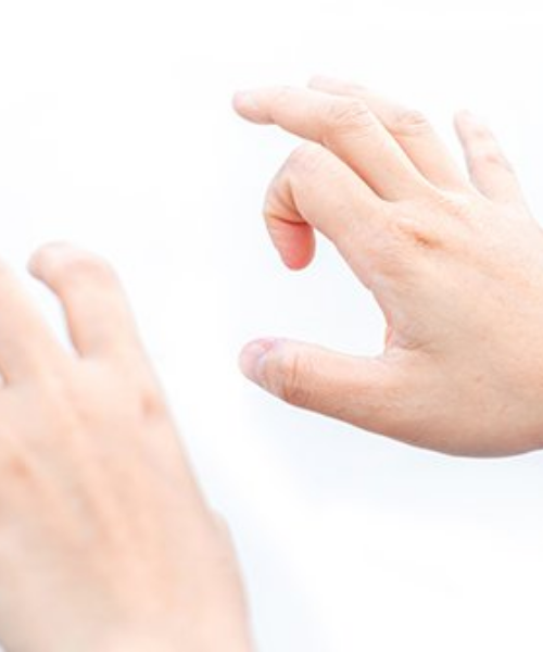 Inflamed Tendon Fingers